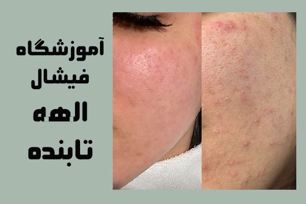 آموزشگاه فیشیال الهه تابنده